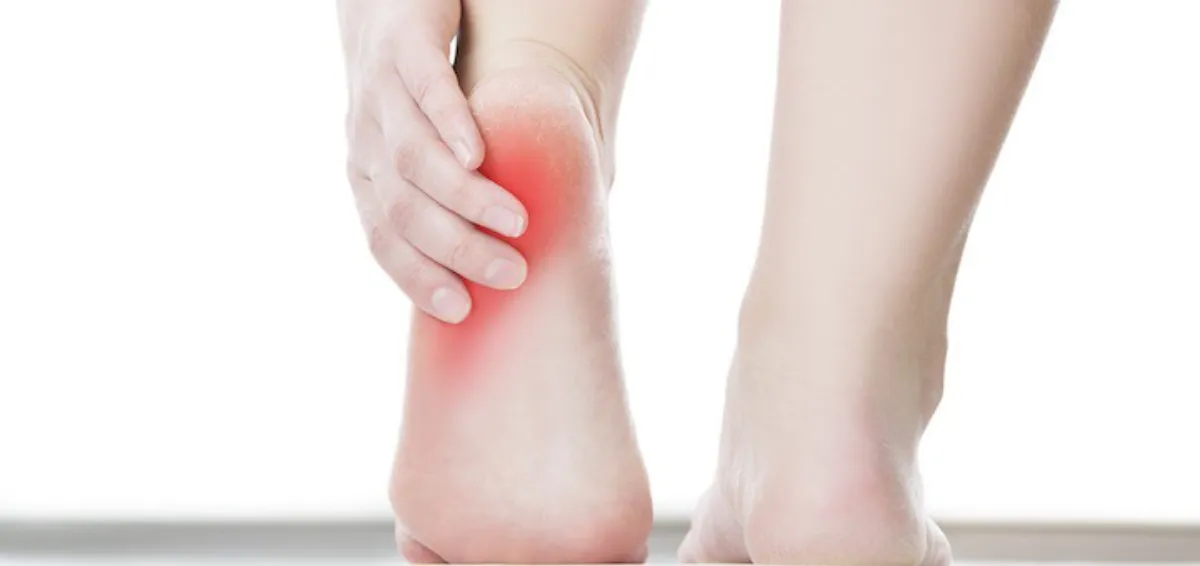Plantar Fasciitis 07